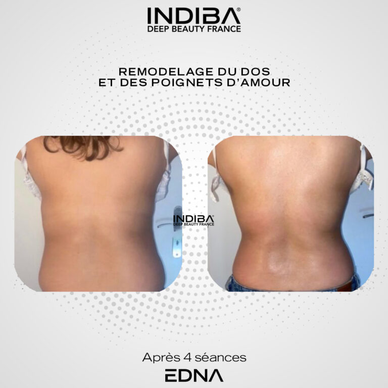 Remodelage-du-dos-2.jpg