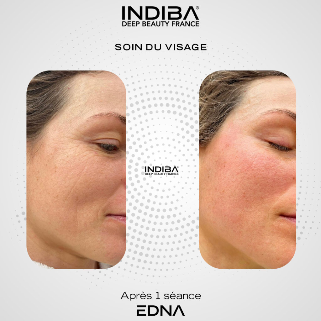 Soin-du-visage-2.png