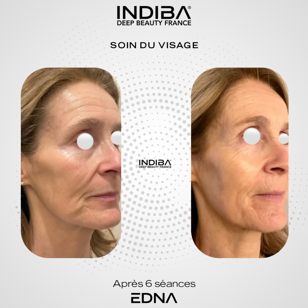 Soin-du-visage-4.png