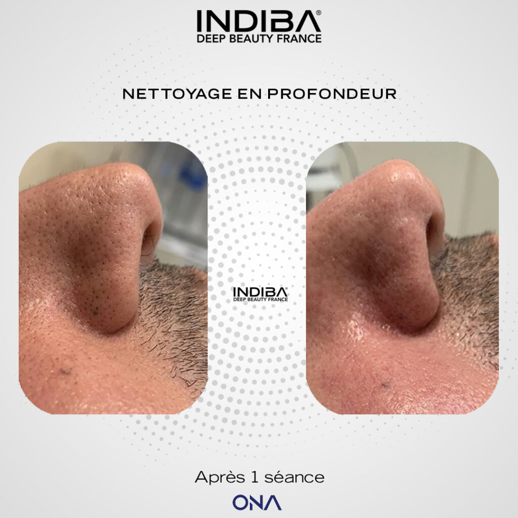 Soin-du-visage-ONA.jpg