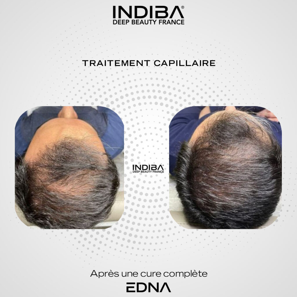 Traitement-cheveux-1.jpg